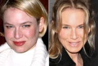 Renee Zellweger Unrecognizable: Plastic Surgery Or Just Age? Have Your Say