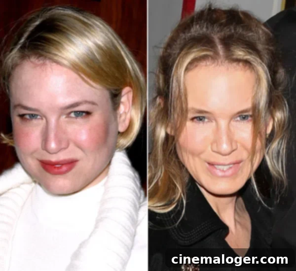 Renee Zellweger Unrecognizable: Plastic Surgery Or Just Age? Have Your Say 1 featured 1231987
