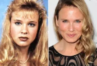 Renee Zellweger: Her High School Face Will Surprise You