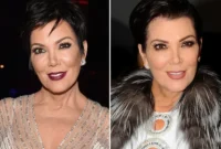 Kris Jenner’s Youthful Transformation: Are Fillers The Secret?