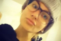 Stephanie Pratt’s Hospital Dash After Spider Bite Leaves Eye Blind Face Numb