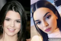 Kendall Jenner’s Lip Transformation: A Pout Timeline
