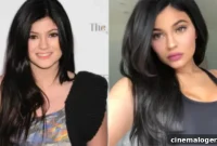Kylie Jenner’s Beauty Evolution: Teen, Pout, and Motherhood