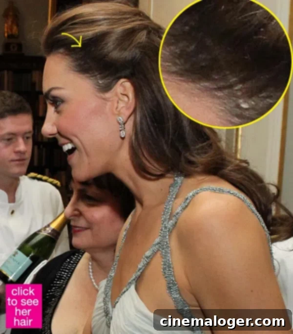 Kate Middleton's Royal Hiatus: The Latest Whispers 1 featured 498721