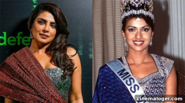 Priyanka Chopra: Botched Surgery Triggered Deep Depression 1 featured 5091777