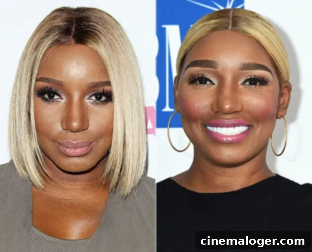 RHOA Star NeNe Leakes' Unrecognizable Post-Surgery Appearance At BMI Stuns Fans 2 NeNe Leakes Before/After