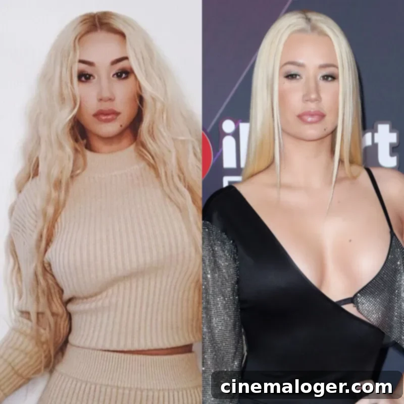 Plastic Surgeons Break Down Iggy Azalea's Apparent $10k Makeover 2 Iggy Azalea Plastic Surgery