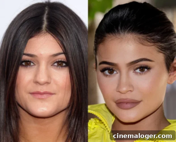 Kylie Jenner Unveils The Real Reason Behind Her Evolving Look 2 Kylie Jenner slams plastic surgery rumors