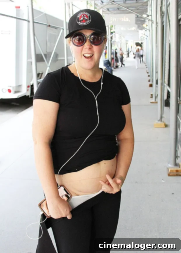 Amy Schumer New York Koşusunda Sezaryen İzini Cesurca Sergiledi 2 Amy Schumer Scar