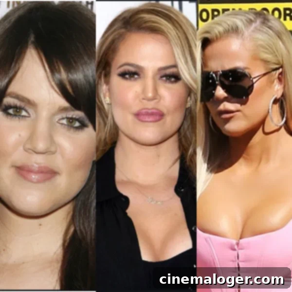 Khloe Kardashian's Fuller Cheeks and Contoured Jawline: A Filler Story 2 Khloe Kardashian