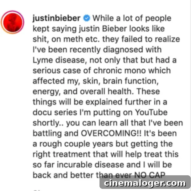 Justin Bieber Debunks Meth Claims, Reveals Lyme Disease Diagnosis 2 Justin Bieber