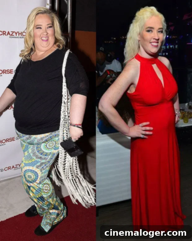 Anna's $47K Makeover: One More Surgery On Her Mind 3 Mama June