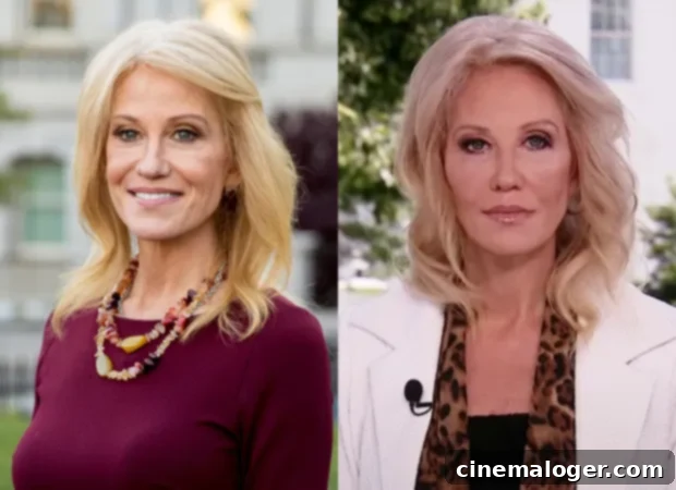 Kellyanne Conway's Ageless Appearance: A Doctor Addresses Surgery Rumors 2 Kellyanne Conway plastic surgery