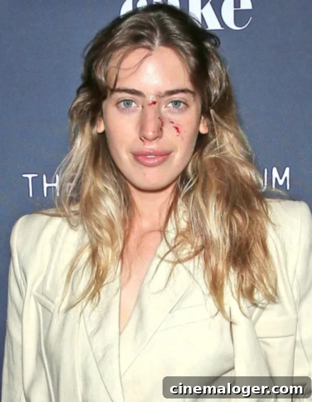 Clara McGregor Braves Red Carpet With Visible Dog Attack Injuries 2 Clara McGregor on the red carpet at The Birthday Cake film premiere in Las Vegas, showing remarkable resilience after a dog bite to her face.