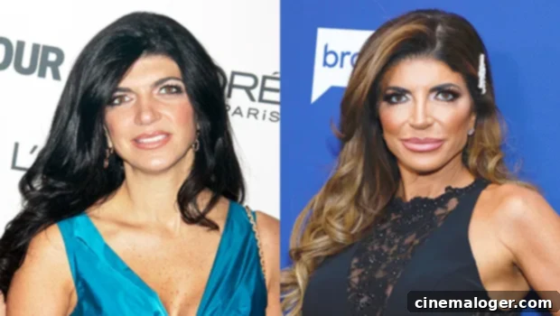 Melissa Gorga Drops Bombshell About Teresa Giudice's Forehead Surgery 2 Teresa Giudice plastic surgery